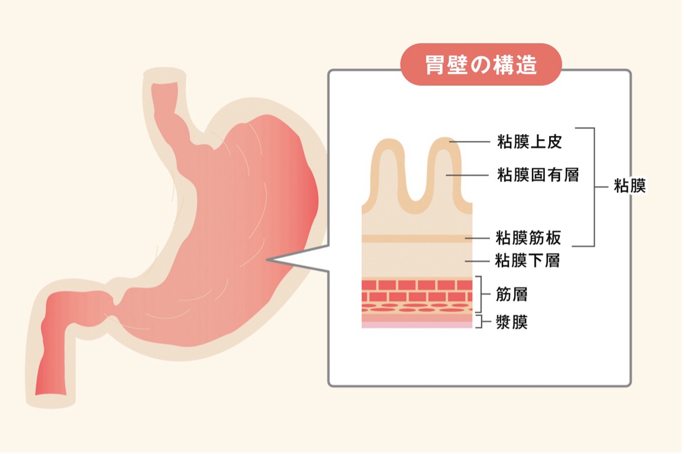 胃の構造の図。胃壁は外側から内側に向かって漿膜、筋層、粘膜下層、そして粘膜(粘膜筋板、粘膜固有層、粘膜上皮から構成)の5層に分かれている。