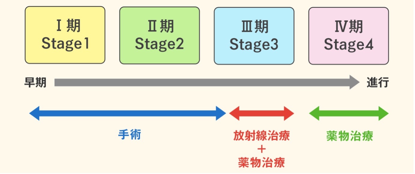 肺がんのステージと治療法を示す図。上段には病期が左から右へ進行順に示されている、I期Stage1、II期Stage2、III期Stage3、IV期Stage4、下段には病期ごとの主な治療法が矢印で示されている、早期から進行へと向かう灰色の矢印の下に、I期からIII期の一部にかけて「手術」、III期に「放射線治療+薬物治療」、IV期に「薬物治療」。